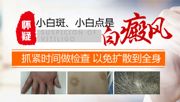 症状危害-白癜风的病情受哪些药物的影响